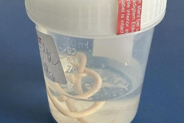 Pacient nemal infarkt ale parazita vykaslal ho na kuriozitu upozornil lekar z Nitry