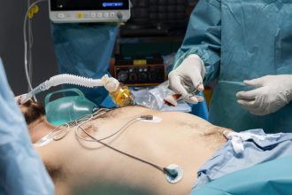 Veda napreduje aj pri najagresivnejsiej rakovine Tri spravy o pokroku v liecbe rakoviny pankreasu